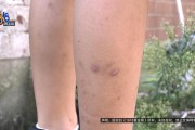8岁儿子被狗咬伤，警察走后狗主人一家改口拒绝赔偿，父母决定起诉维权